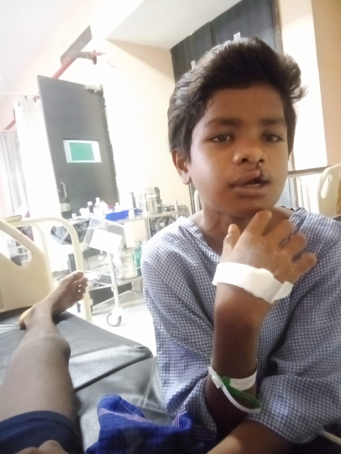 सफलता की कहानी :  ‘चिरायु’ दल ने लौटाई मुस्कान, जन्मजात कटे होंठ और तालु से मिली मुक्ति